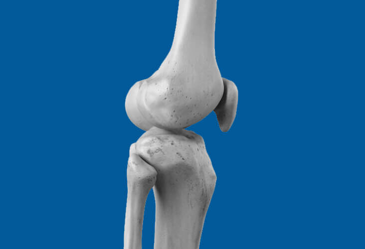Orthopédiste du genou - Lausanne