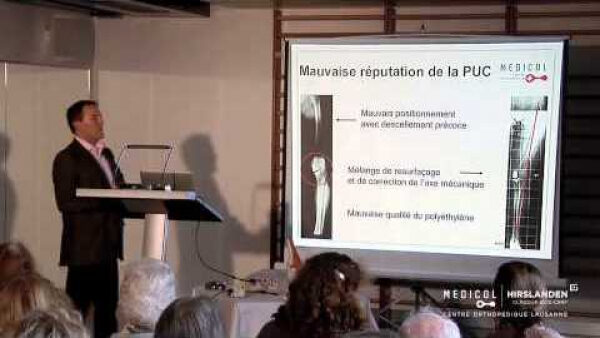 Prothèse du genou - options, techniques et réhabilitation - Orthopédiste Lausanne