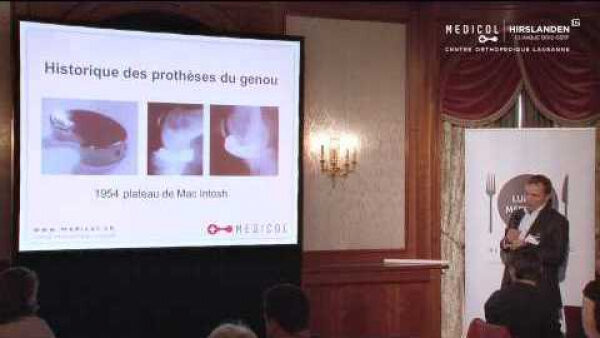 Prothèse unicompartimentale du genou - indications et bénéfices - Médecin orthopédiste 1000 lausanne