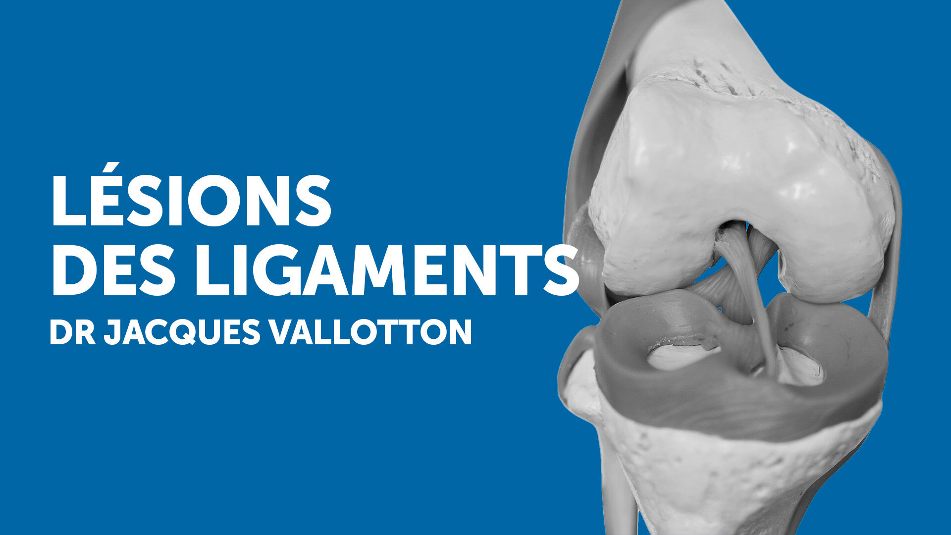 Knee sprain: should you be worried?