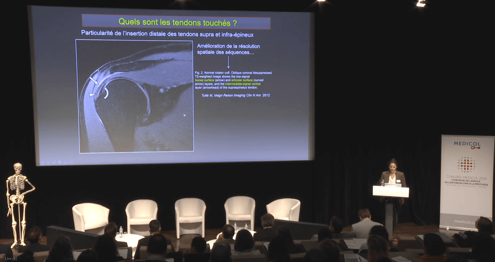 MRI imaging of the rotator cuff tendons: value of ABER sequences