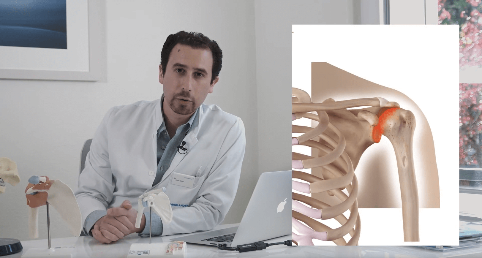 L'arthrose de l'épaule par le Dr Ludovic Glanz