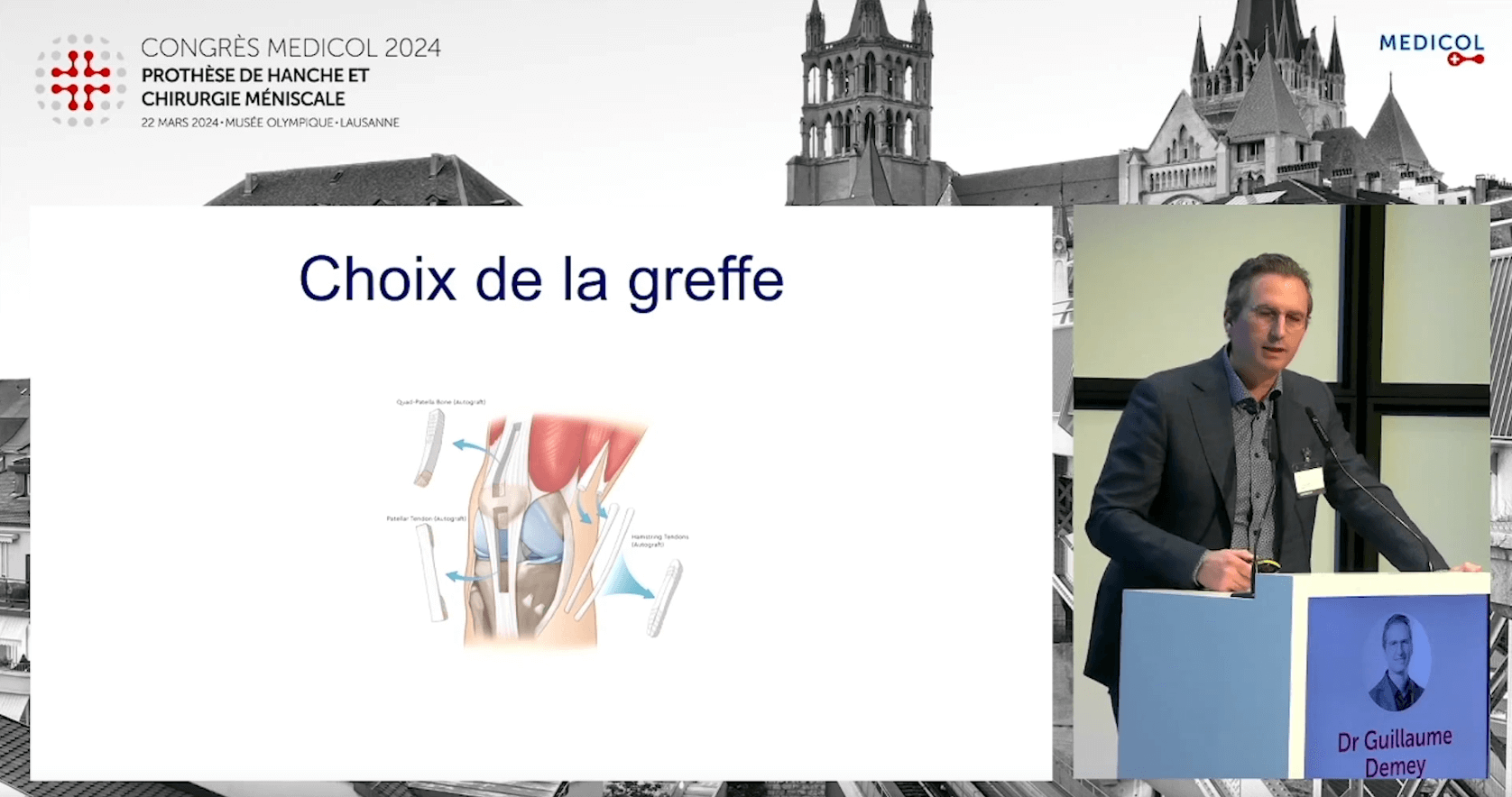 ACL grafts and meniscal injuries in athletes