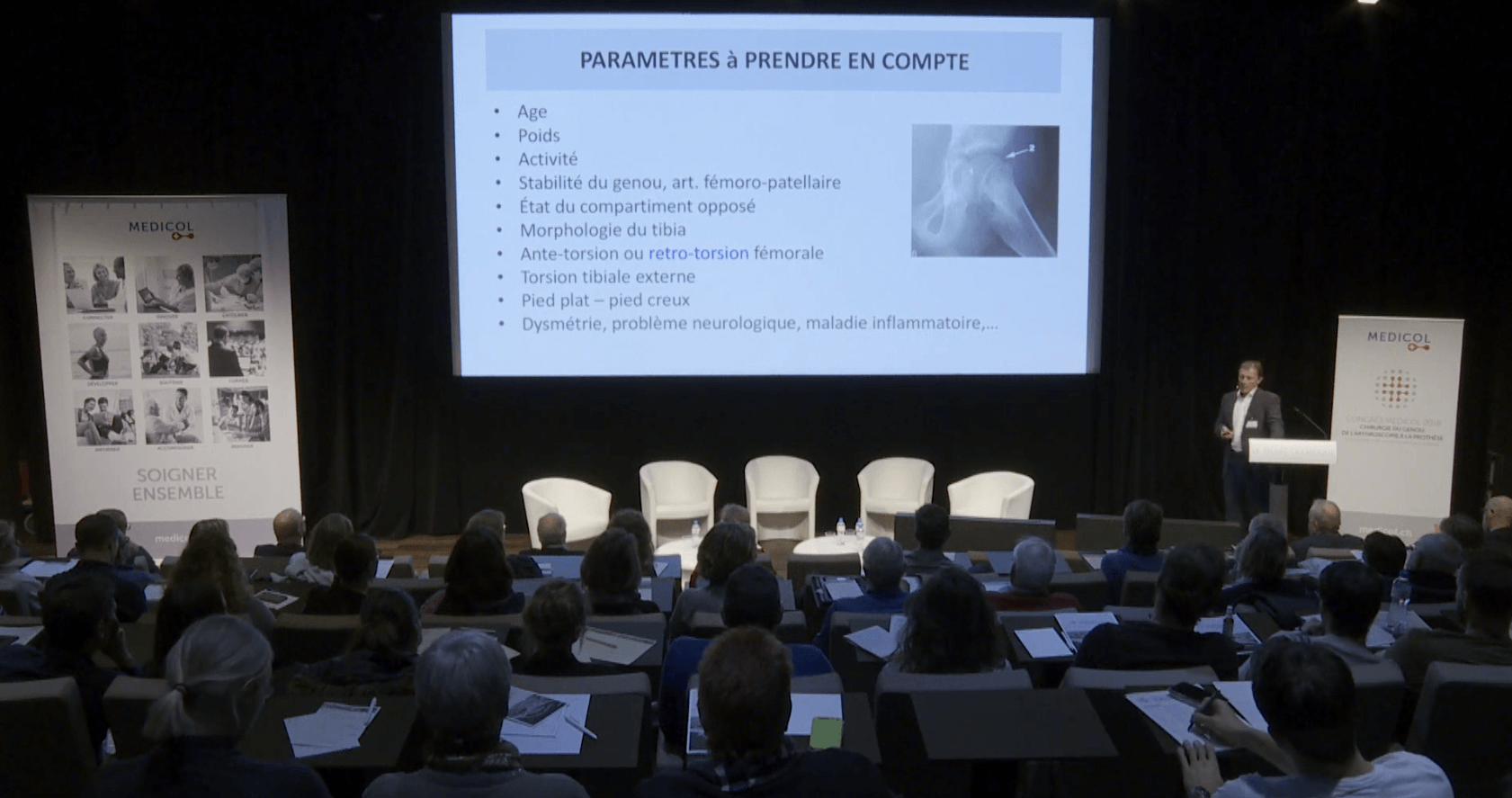 Ostéotomie du genou : indications et résultats