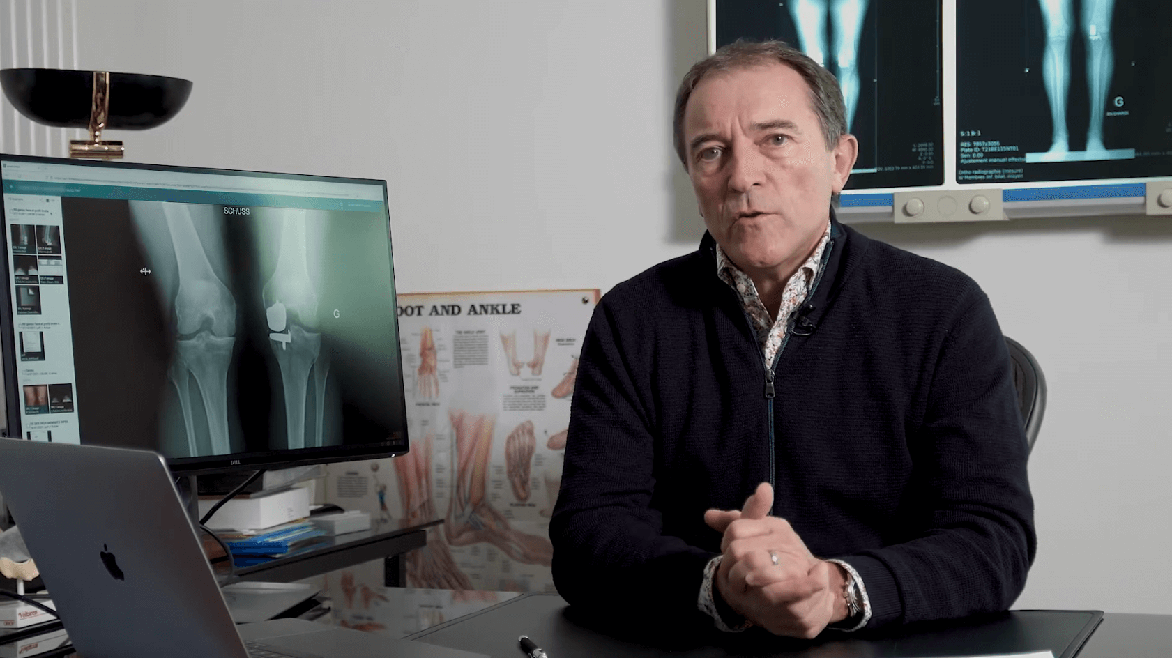 Revision after partial knee replacement: indications and results